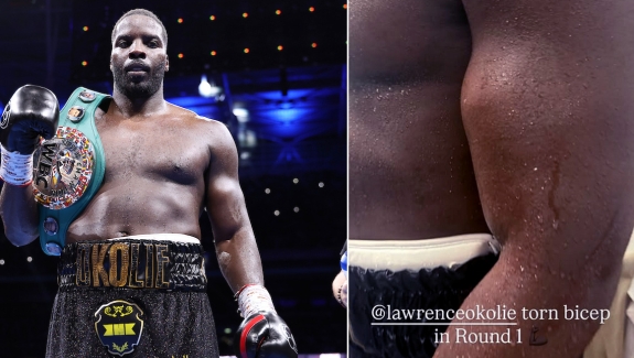 OKOLIE WALCZYŁ Z ZERWANYM BICEPSEM